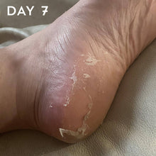 Load image into Gallery viewer, +maskology FOOT PEEL Professional Foot Treatment